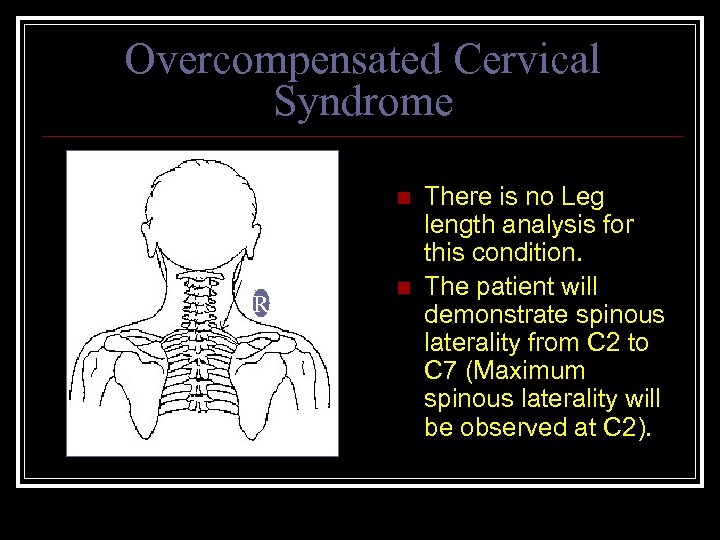 Overcompensated Cervical Syndrome n R n There is no Leg length analysis for this