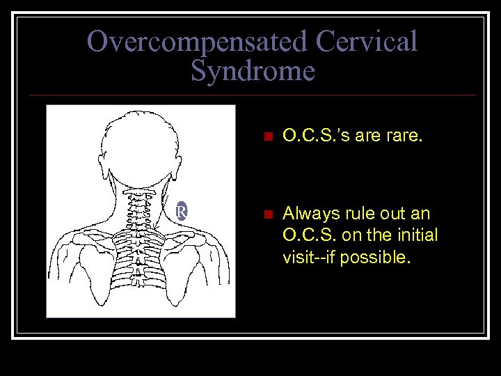 Overcompensated Cervical Syndrome n R O. C. S. ’s are rare. n Always rule