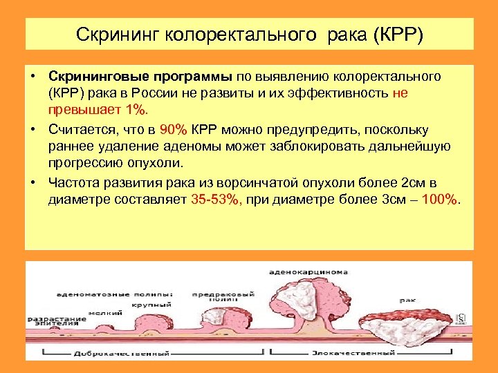 Метастазы при колоректальном раке. Скрининг и ранняя диагностика опухолей. Скрининг на выявление злокачественных. Скрининг на выявление онкологических заболеваний.