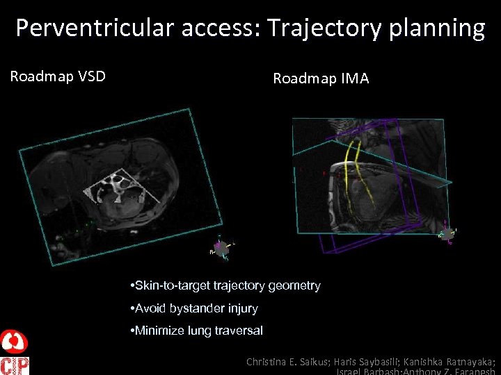 Perventricular access: Trajectory planning Roadmap VSD Roadmap IMA • Skin-to-target trajectory geometry • Avoid