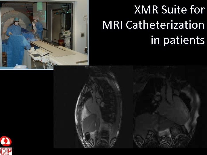 XMR Suite for MRI Catheterization in patients 