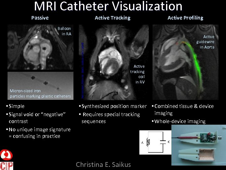 MRI Catheter Visualization Passive Active Tracking Micron-sized iron particles marking plastic catheters • Simple