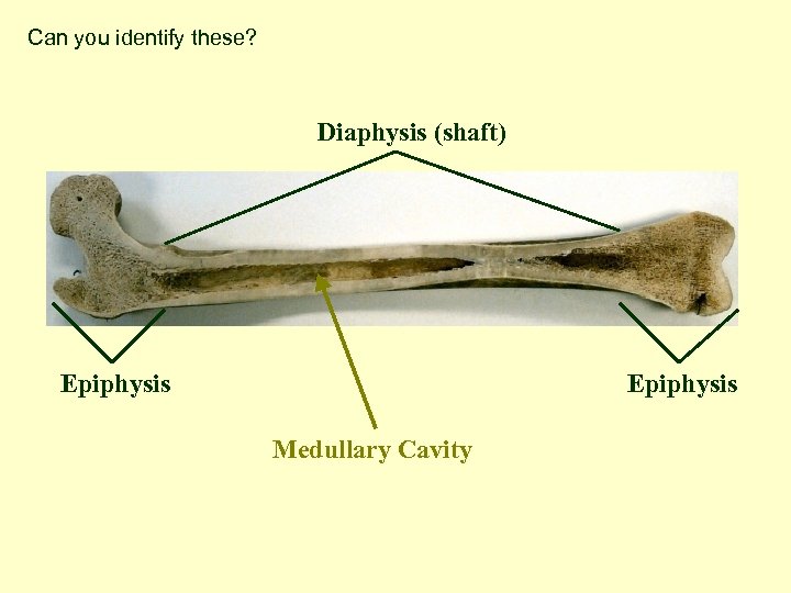 Can you identify these? Diaphysis (shaft) Epiphysis Medullary Cavity 