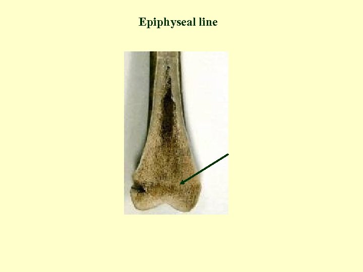 Epiphyseal line 