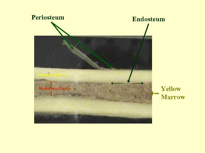 Periosteum Endosteum Compact Bone Medullary Cavity Yellow Marrow 