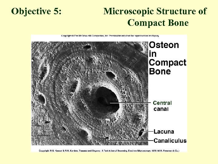 Objective 5: Microscopic Structure of Compact Bone Central 