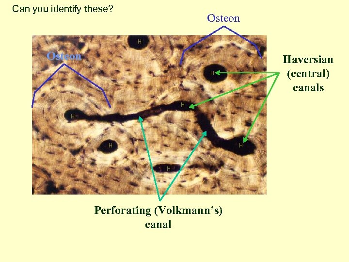 Can you identify these? Osteon Haversian (central) canals H H H Perforating (Volkmann’s) canal