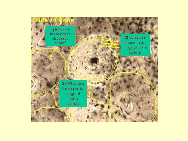 1) What are (Osteon) these circles structures called? 3) What are these partial rings