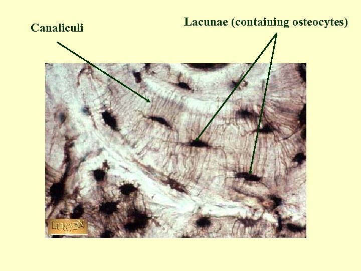 Canaliculi Lacunae (containing osteocytes) 