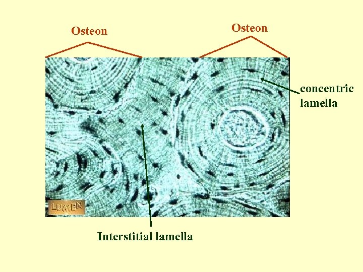 Osteon concentric lamella Interstitial lamella 