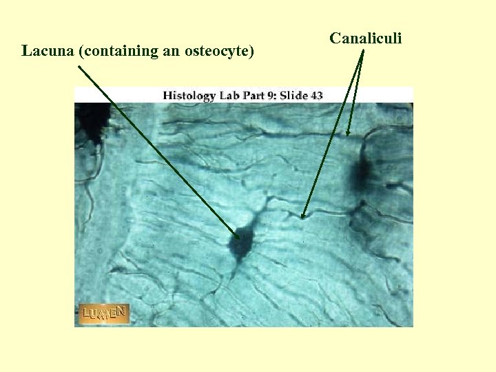 Lacuna (containing an osteocyte) Canaliculi 