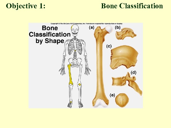 Objective 1: Bone Classification 