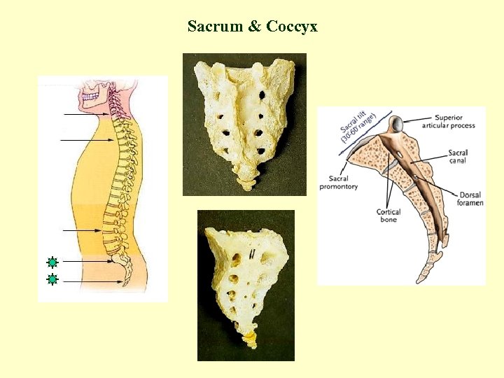 Sacrum & Coccyx 