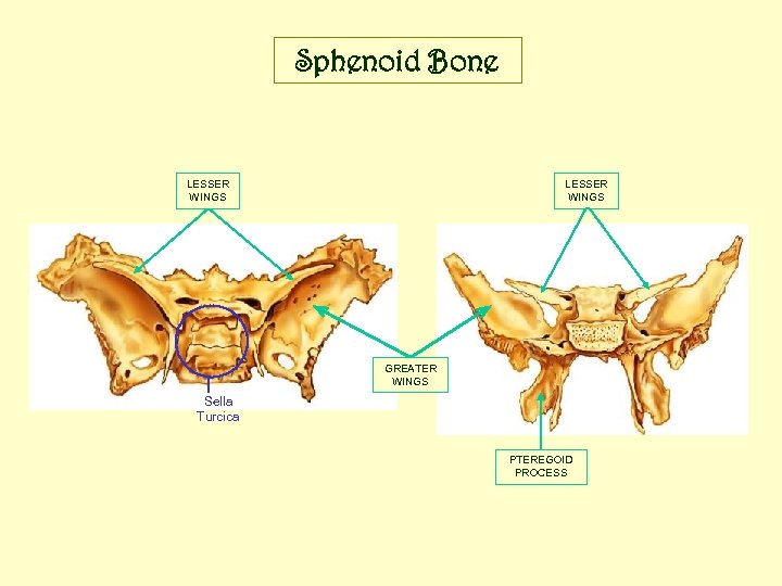 Sphenoid Bone LESSER WINGS GREATER WINGS Sella Turcica PTEREGOID PROCESS 