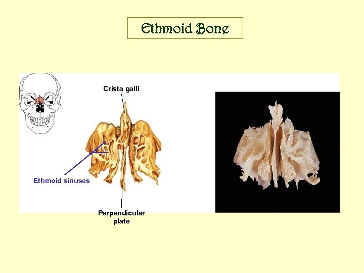 Ethmoid Bone Crista galli Ethmoid sinuses Perpendicular plate 