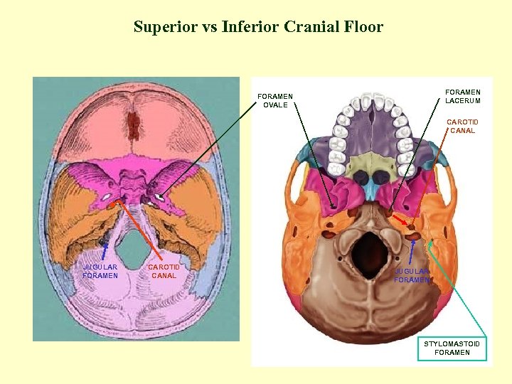 Superior vs Inferior Cranial Floor FORAMEN LACERUM FORAMEN OVALE CAROTID CANAL JUGULAR FORAMEN STYLOMASTOID