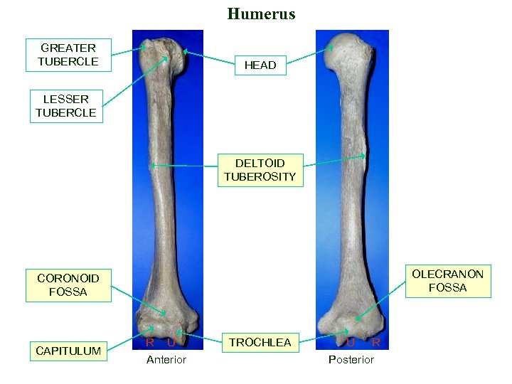 Humerus GREATER TUBERCLE HEAD LESSER TUBERCLE DELTOID TUBEROSITY OLECRANON FOSSA CORONOID FOSSA CAPITULUM R