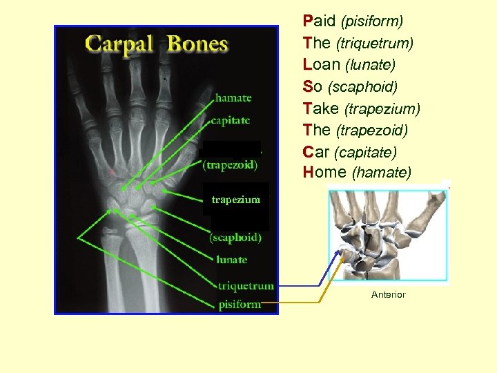 Paid (pisiform) The (triquetrum) Loan (lunate) So (scaphoid) Take (trapezium) The (trapezoid) Car (capitate)