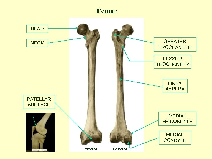 Femur HEAD GREATER TROCHANTER NECK LESSER TROCHANTER LINEA ASPERA PATELLAR SURFACE MEDIAL EPICONDYLE MEDIAL