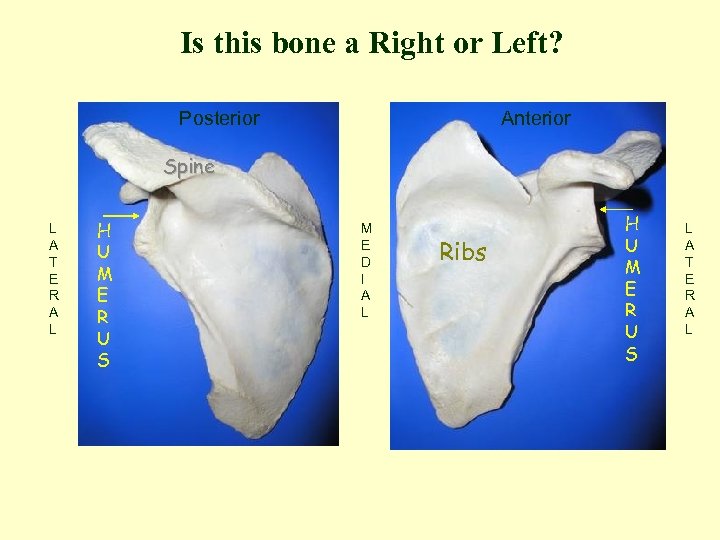 Is this bone a Right or Left? Posterior Anterior Spine L A T E