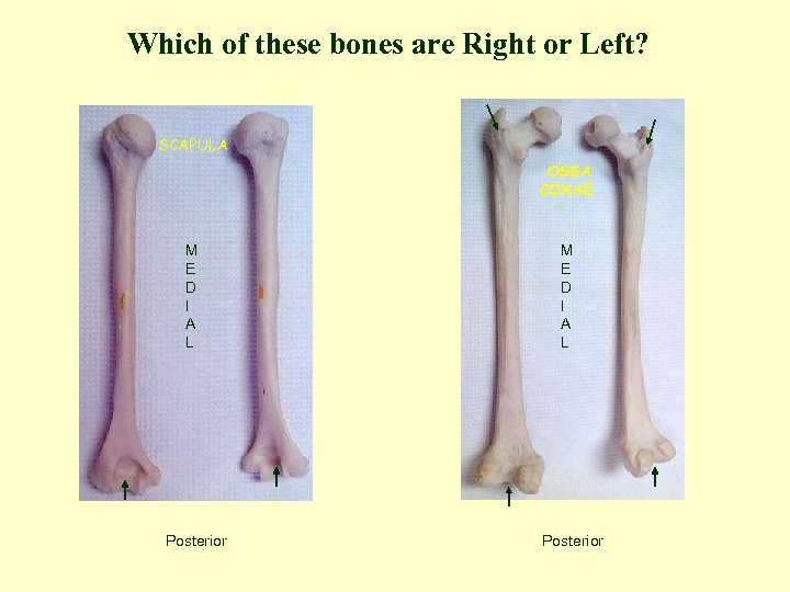 Which of these bones are Right or Left? SCAPULA OSSA COXAE M E D