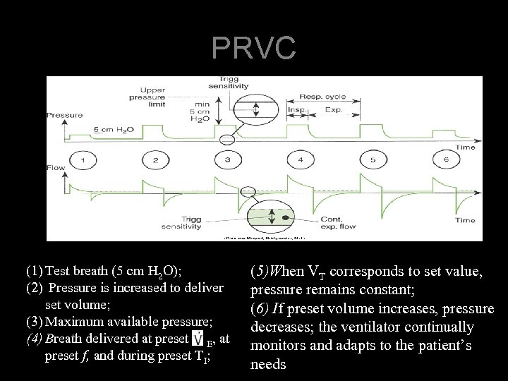PRVC (1) Test breath (5 cm H 2 O); (2) Pressure is increased to