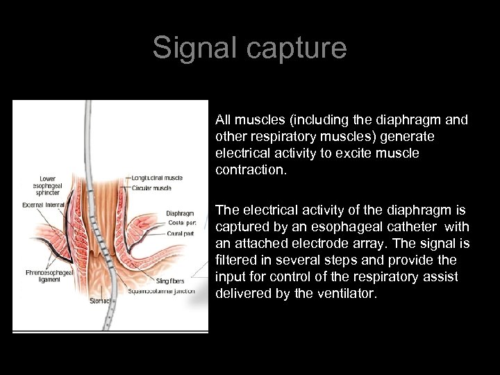 Signal capture • All muscles (including the diaphragm and other respiratory muscles) generate electrical