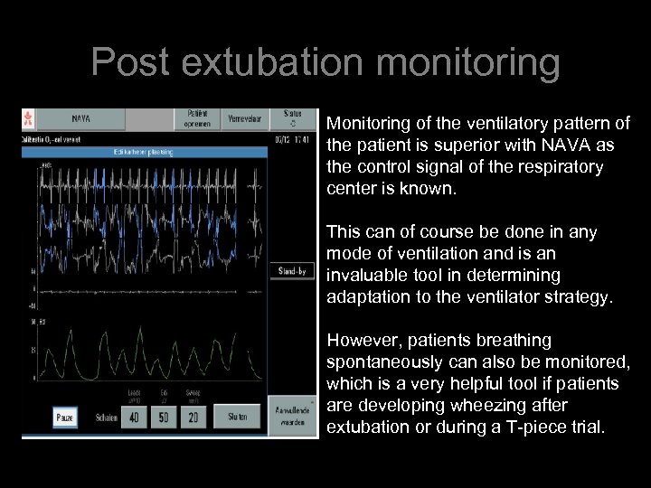 Post extubation monitoring Monitoring of the ventilatory pattern of the patient is superior with