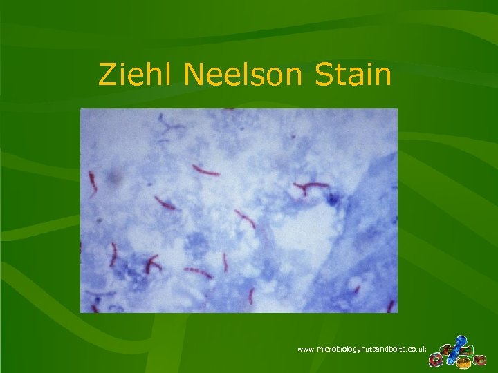 Ziehl Neelson Stain www. microbiologynutsandbolts. co. uk 