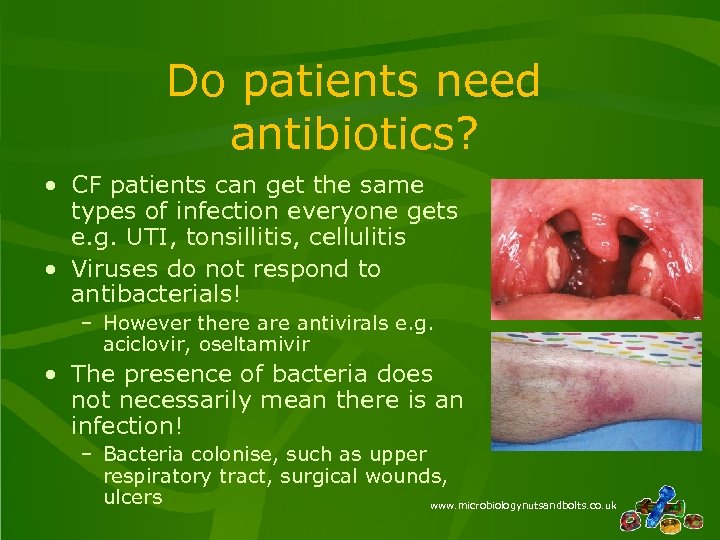 Do patients need antibiotics? • CF patients can get the same types of infection