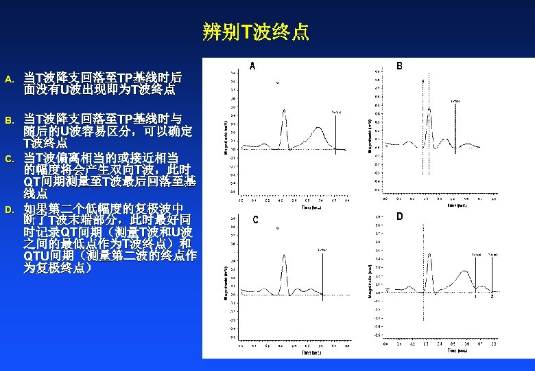 辨别T波终点 A. 当T波降支回落至TP基线时后 面没有U波出现即为T波终点 B. 当T波降支回落至TP基线时与 随后的U波容易区分，可以确定 T波终点 当T波偏离相当的或接近相当 的幅度将会产生双向T波，此时 QT间期测量至T波最后回落至基 线点 如果第二个低幅度的复极波中 断了T波末端部分，此时最好同