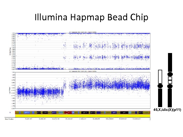 Illumina Hapmap Bead Chip 46, X, idic(X)(p 11) 