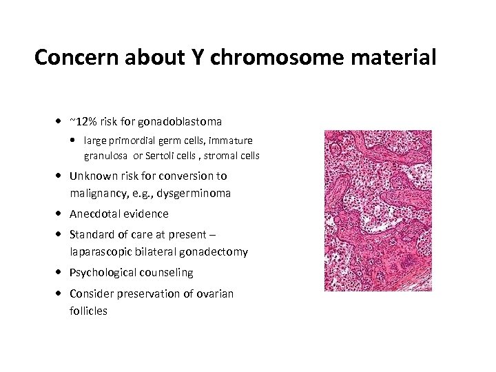 Concern about Y chromosome material ~12% risk for gonadoblastoma large primordial germ cells, immature