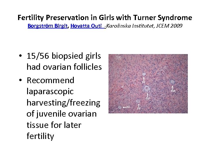 Fertility Preservation in Girls with Turner Syndrome Borgström Birgit, Hovatta Outi -Karolinska Institutet, JCEM