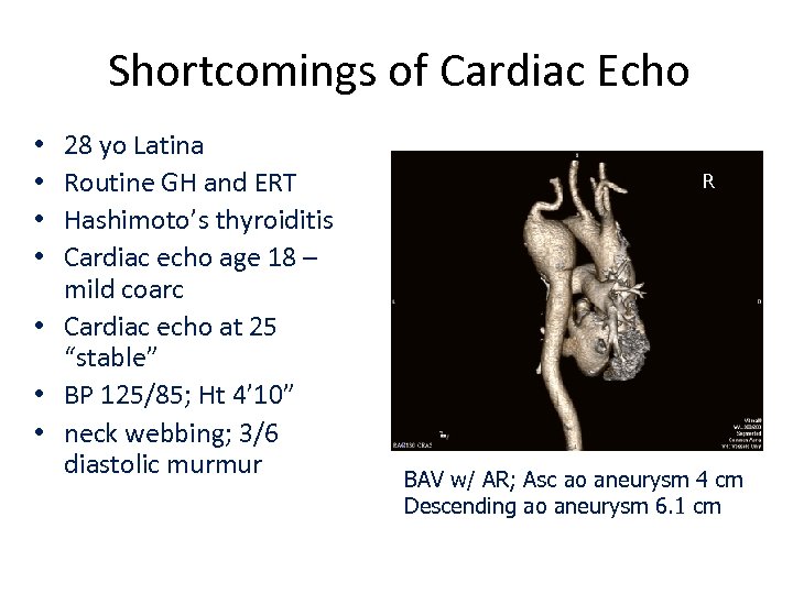 Shortcomings of Cardiac Echo 28 yo Latina Routine GH and ERT Hashimoto’s thyroiditis Cardiac