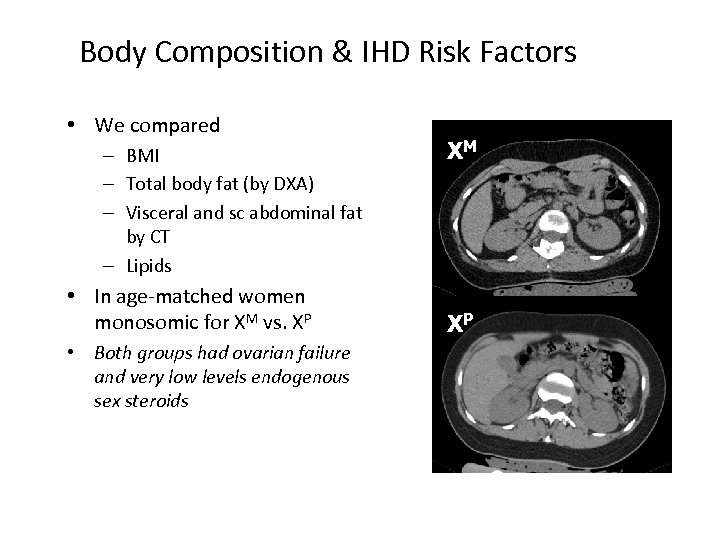 Body Composition & IHD Risk Factors • We compared – BMI – Total body