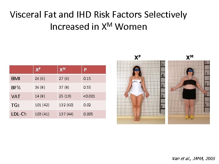 Visceral Fat and IHD Risk Factors Selectively Increased in XM Women XP XP XM