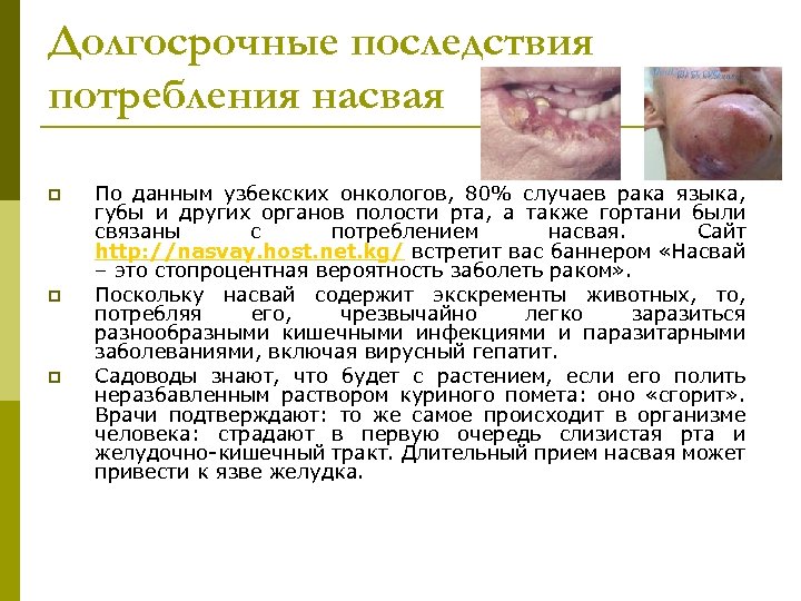 Долгосрочные последствия потребления насвая p p p По данным узбекских онкологов, 80% случаев рака