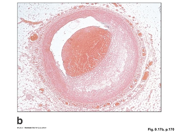 Fig. 9. 17 b, p. 170 