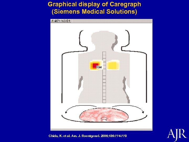 Graphical display of Caregraph (Siemens Medical Solutions) Chida, K. et al. Am. J. Roentgenol.