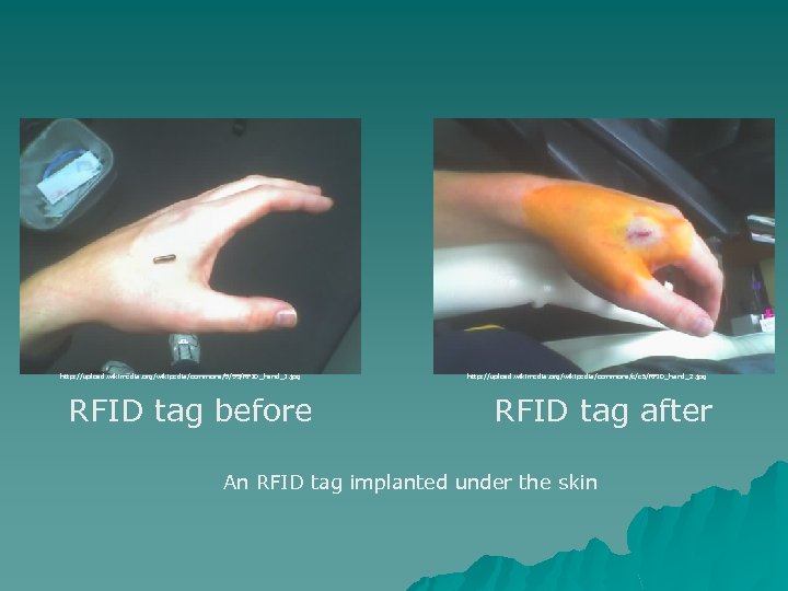 http: //upload. wikimedia. org/wikipedia/commons/9/99/RFID_hand_1. jpg RFID tag before http: //upload. wikimedia. org/wikipedia/commons/c/c 5/RFID_hand_2. jpg