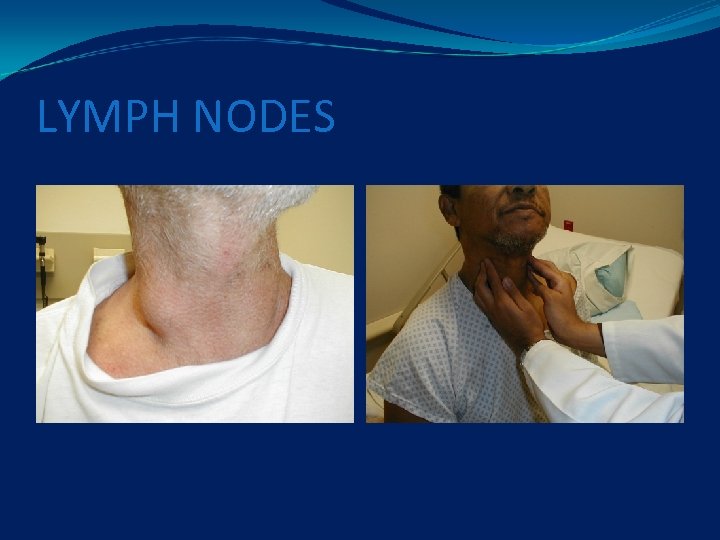 LYMPH NODES 