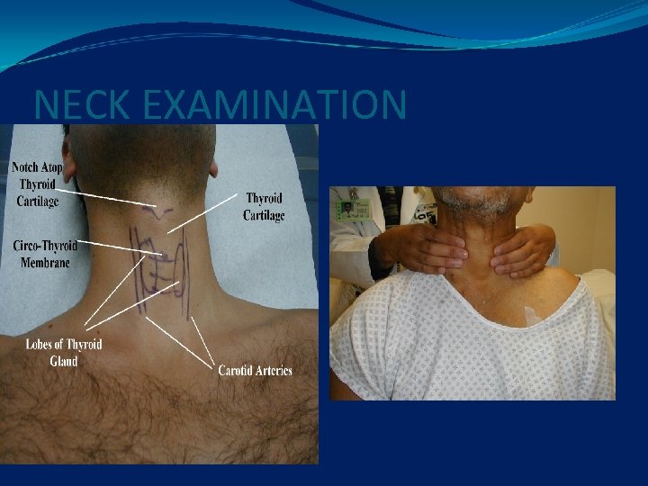 NECK EXAMINATION 