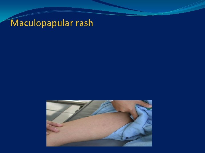 Maculopapular rash 