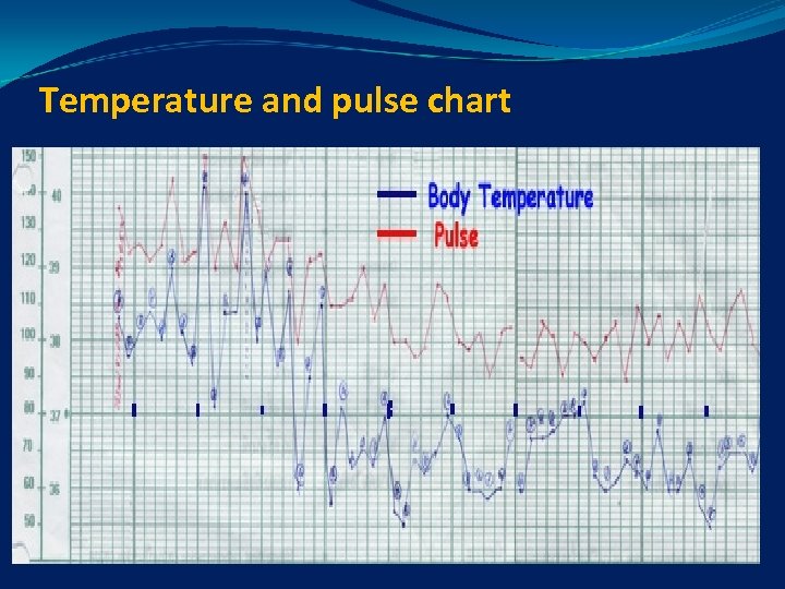 Temperature and pulse chart 