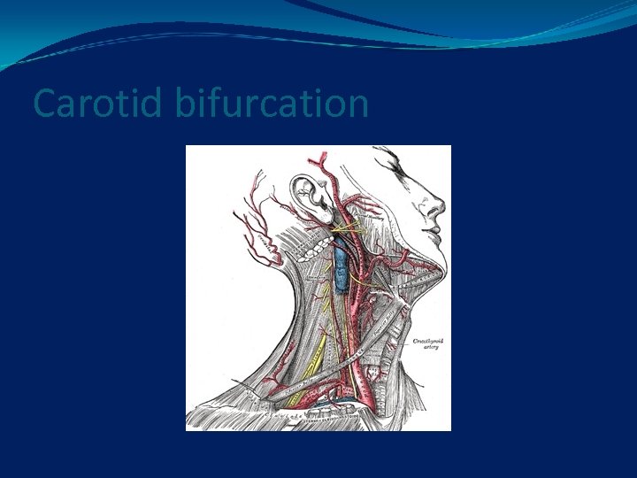 Carotid bifurcation 