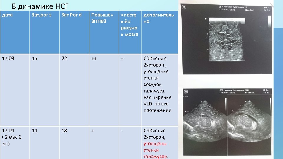 В динамике НСГ дата Зат. por s Зат Por d Повышен ЭППВЗ «пестр ый»