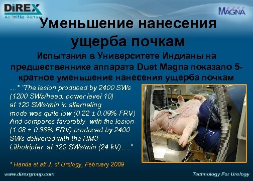 Уменьшение нанесения ущерба почкам Испытания в Университете Индианы на предшественнике аппарата Duet Magna показало