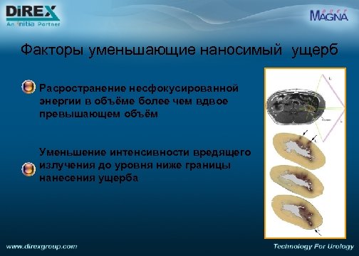 Факторы уменьшающие наносимый ущерб Расространение несфокусированной энергии в объёме более чем вдвое превышающем объём