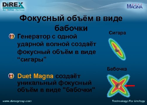 Фокусный объём в виде бабочки Генератор с одной ударной волной создаёт фокусный объём в